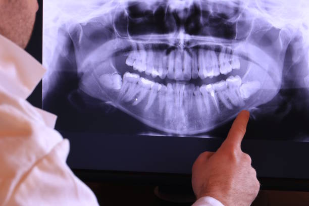 Best Emergency Pediatric Dental Care in Annapolis, MD