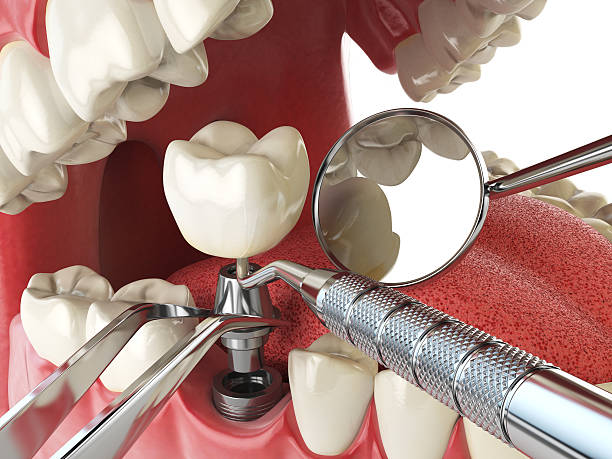 Best 24-Hour Emergency Dental Care in Annapolis, MD
